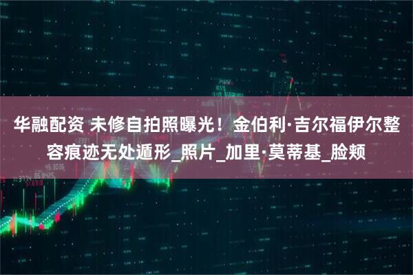 华融配资 未修自拍照曝光！金伯利·吉尔福伊尔整容痕迹无处遁形_照片_加里·莫蒂基_脸颊